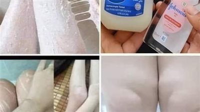 زيت جونسون والفازلين في تبييض البشرة وإزالة التصبغات بشكل نهائي