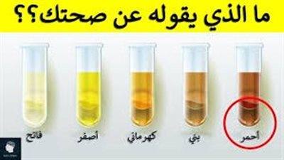 اعرف المؤشرات الصحية للون البول.. ومتى تجب زيارة الطبيب؟ 