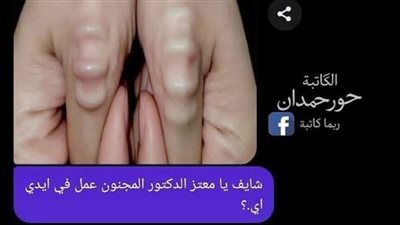 رجعت من عند الدكتور