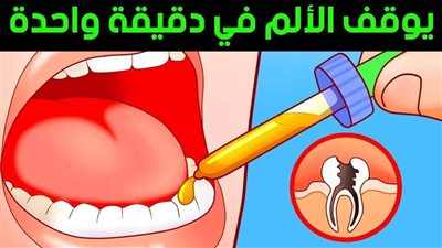 علاج الم الاسنان 