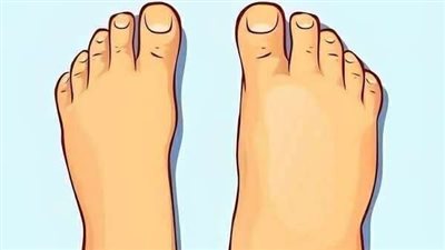 كيف تتخلص من احتباس السوائل في الجسم
