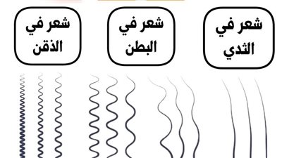 الشعر