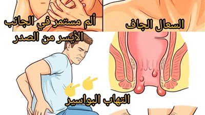 تخلص من هذه الأعراض المزعجة بمعرفة السبب مع الحل  السعال الجاف