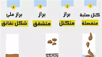 كتل صلبة منفصلة إمساك شديد