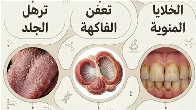 الحلايا المنويه وتعفن الفاكهه وترهل الجلد واصفرار الاسنان قوانص الدجاج ولسان العجل