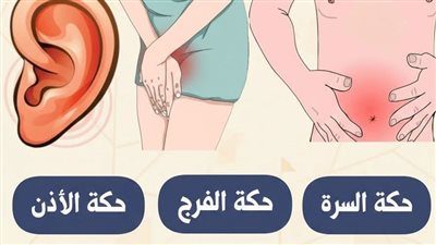 حكة السرة